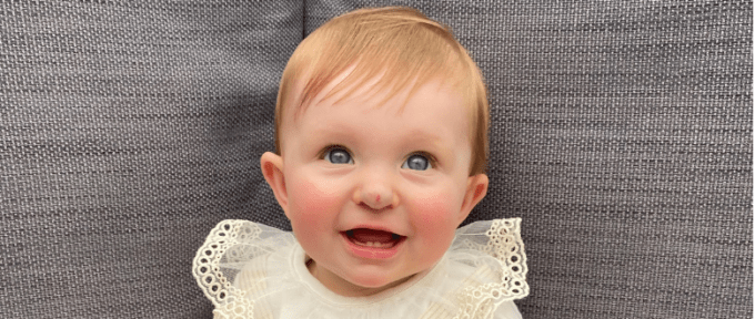 close up of theia with hemangioma